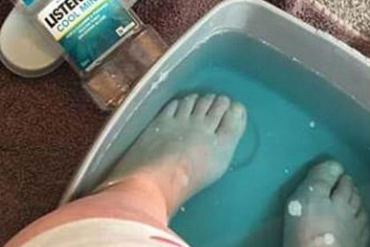 Merendam Kaki Dengan Obat Kumur, Ternyata ini  Manfaatnya