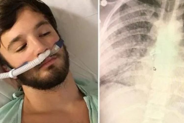 Akibat Menggunakan Vape, Pria Ini Mengalami Kejang- Kejang Tanpa Sebab