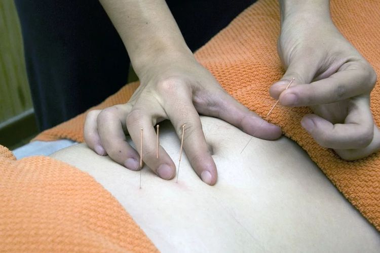 Apakah Terapi Akupuntur Bisa Mengatasi Depresi?