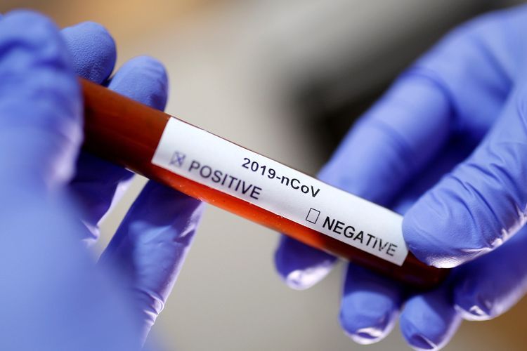 Antibiotik Hingga Disinfektan, Mana yang Ampuh Lumpuhkan Virus Korona?