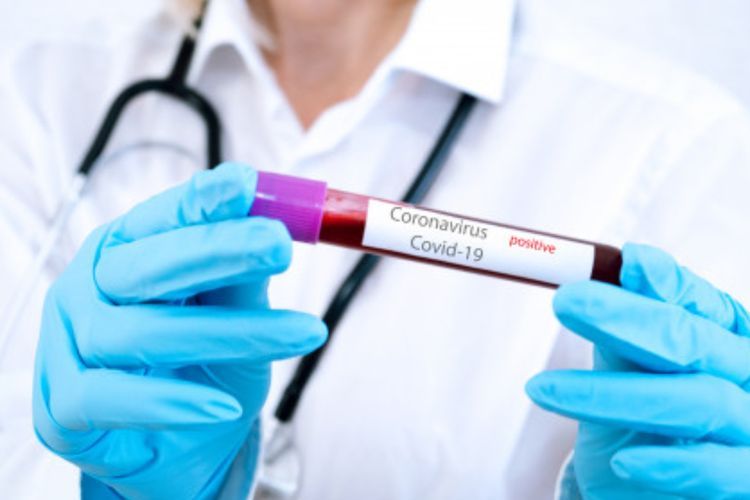 Waspada, Penggunaan AC Berlebih Bikin Virus Corona `Berkembang Biak`