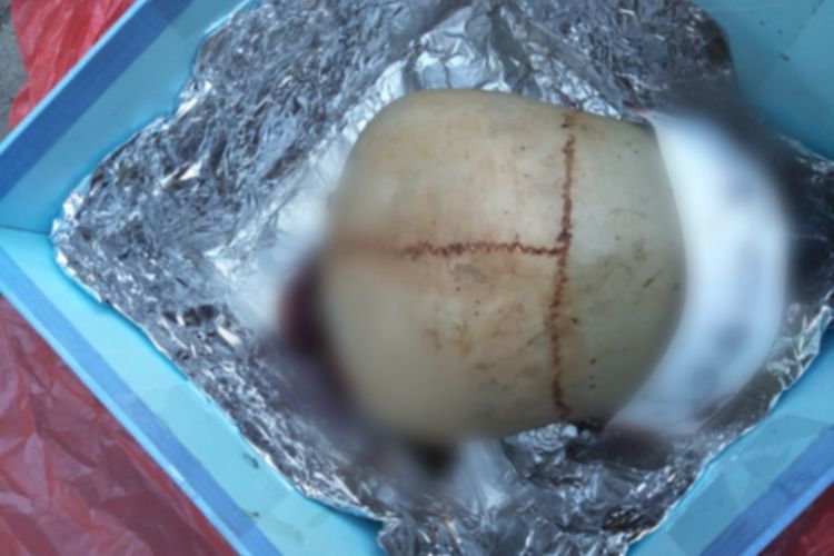 Pengusaha Ini Dikirimi Tengkorak Kepala Manusia dengan Bercak Darah, Begini Foto-fotonya!