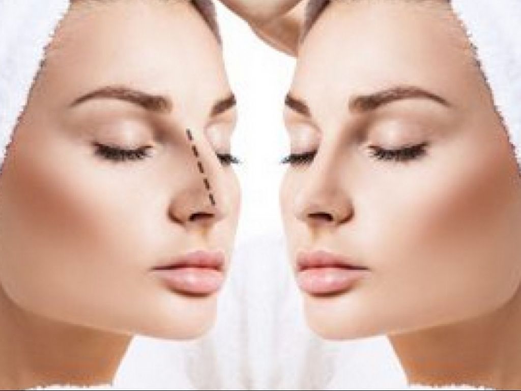 Bikin Merinding! Begini Kondisi Wanita Korban Gagal Operasi Hidung di Klinik Jaktim