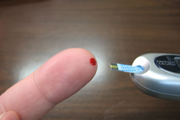 Saat Kadar Gula Darah Tinggi Retinopati Diabetik Kondisi yang Mengkhawatirkan