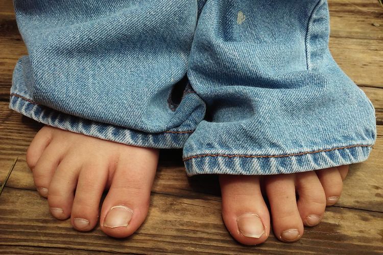 Kuku Kaki Kuning Bisa Jadi Tanda Diabetes Tipe-2