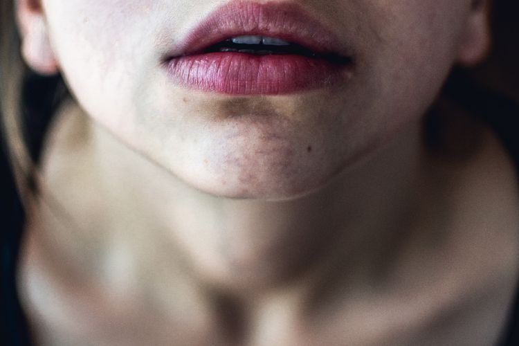 Atasi dengan 3 Bahan Alami Ini saat Bibir Pecah-pecah di Musim Dingin