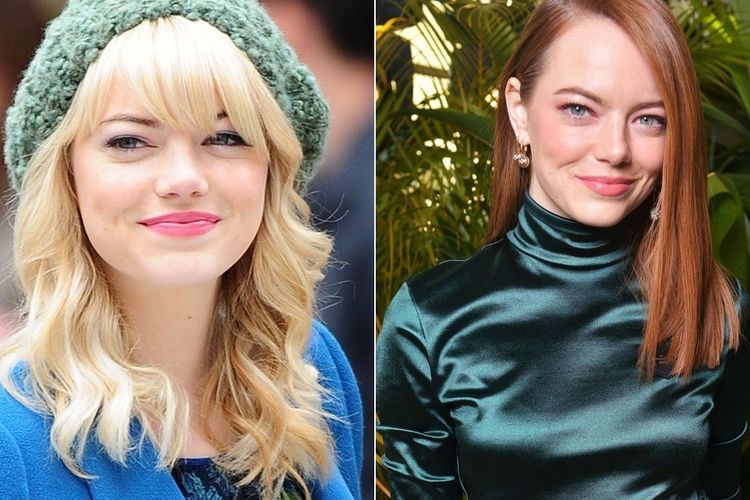 Selamat! Emma Stone Tengah Hamil Anak Pertama