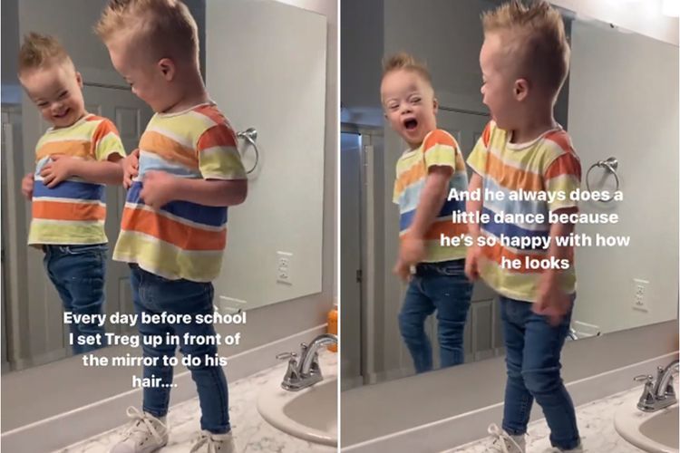 Gemas! Bocah Down Syndrome ini Selalu Menari di Depan Cermin Sebelum Berangkat Ke Sekolah 