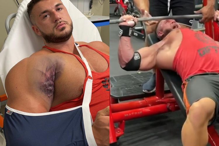 Video Mengerikan Binaragawan Coba Bench Press 220kg, Tapi Ototnya Malah Bergeser & Cedera