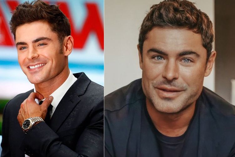Wajahnya Berubah Drastis, Zac Efron Diduga Oplas, Dokter Bedah Plastik: Kebanyakan Filler