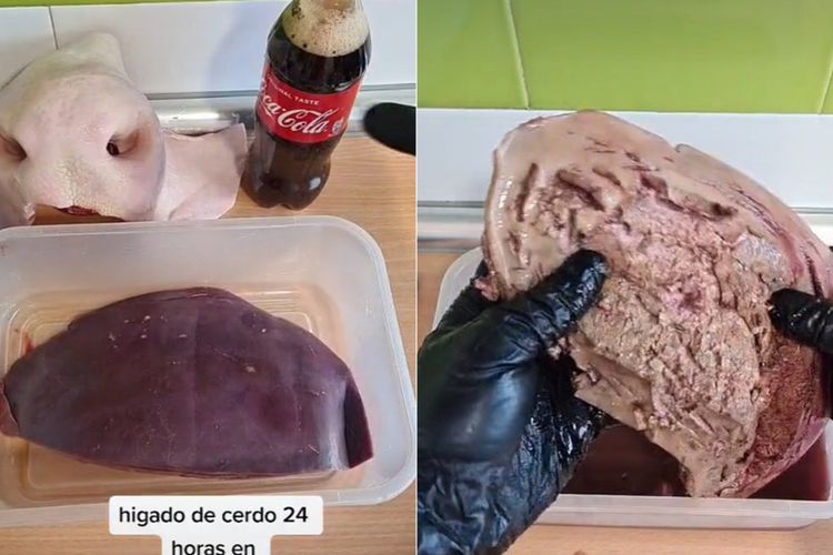 Beginilah Efeknya Pada Liver Jika Terlalu Banyak Minum Soda
