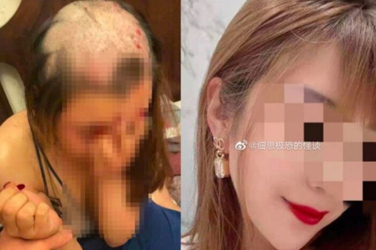 Miris, Suami Ini Mencukur Rambut Istrinya Hingga Botak, Karena Diduga Selingkuh