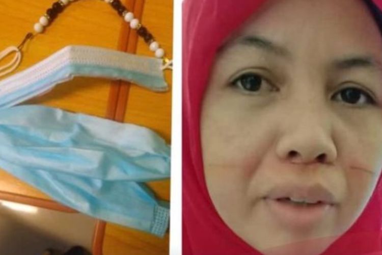 Wajah Guru SD di Lampung Ini Luka Kena Sayat Benang Layang-layang, Masker Sampai Robek