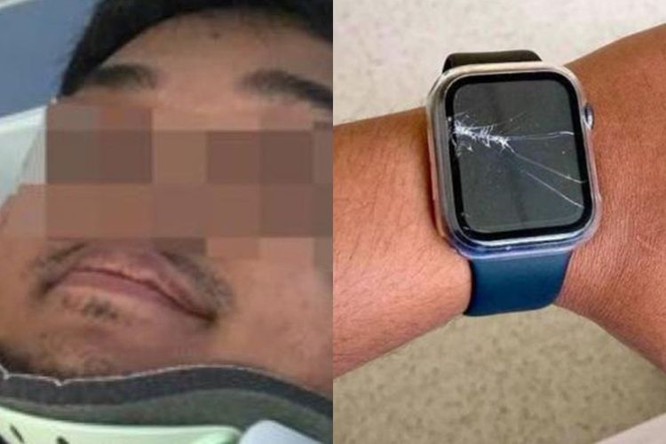 Beruntung! Pria Berhasil Selamat dari Kecelakaan Berkat Apple Watch-nya Menelpon Ambulans