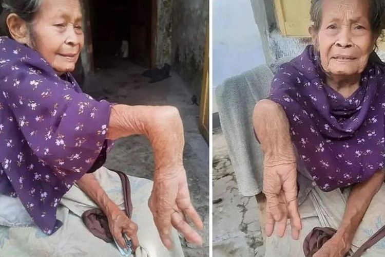 Kisah Pilu Nenek Demi yang Hidup Sebatang Kara di Tegal, Tangan Patah Sejak Puluhan Tahun