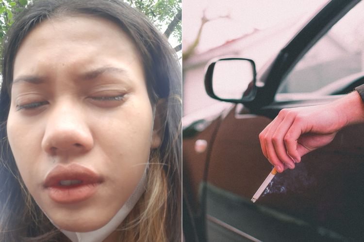 Cewek Ini Jadi Korban Pemotor yang Merokok di Jalan, Mata Tak Bisa Dibuka karena Abu Rokok