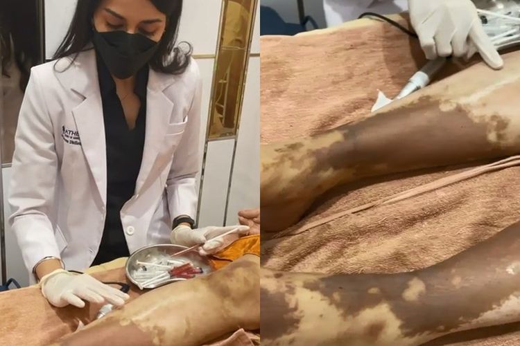 Pakai Lotion 'Abal-abal', Kulit Wanita Ini Malah Berubah Kemerahan & Berujung Gosong
