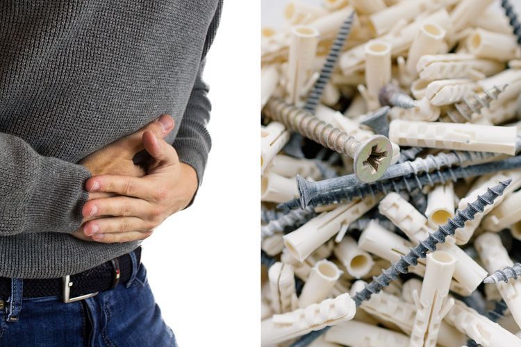 Punya Hobi Makan Benda Asing, Keluarga Pria Ini Tak  Menyangka Kalau Ia Makan 600 Paku