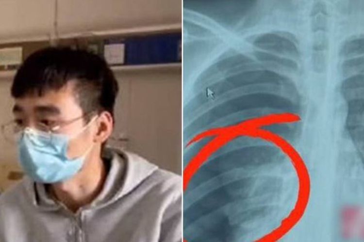 Nyanyi Terlalu Kuat Saat Karaoke, Pria Ini Dilarikan ke  RS karena Masalah Paru-paru