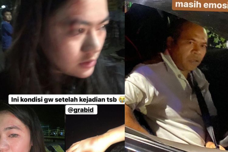 Wanita yang Dianiaya Driver GrabCar Lapor Polisi, Grab Janji akan Tanggung Jawab