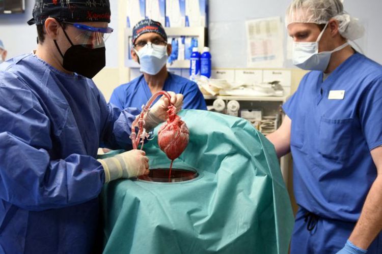Transplantasi Jantung Babi ke Manusia Berhasil, Pertama Kalinya dalam Sejarah