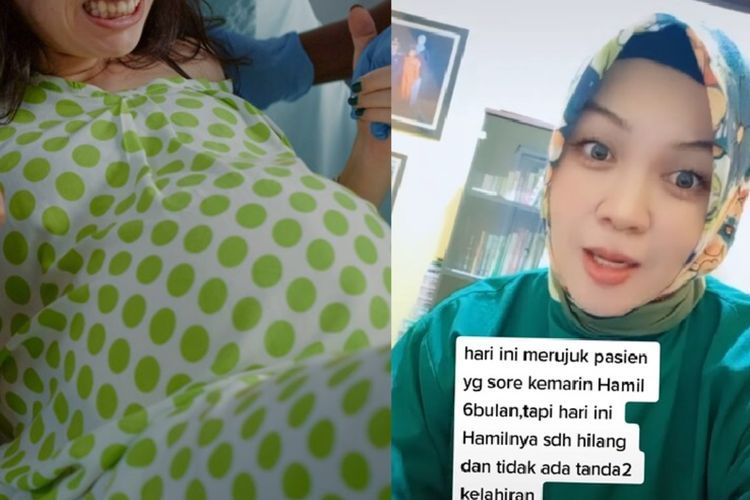 Viral Cerita Mistis Dokter di Tiktok Soal Bayi dalam Kandungan yang Menghilang, Benarkah?
