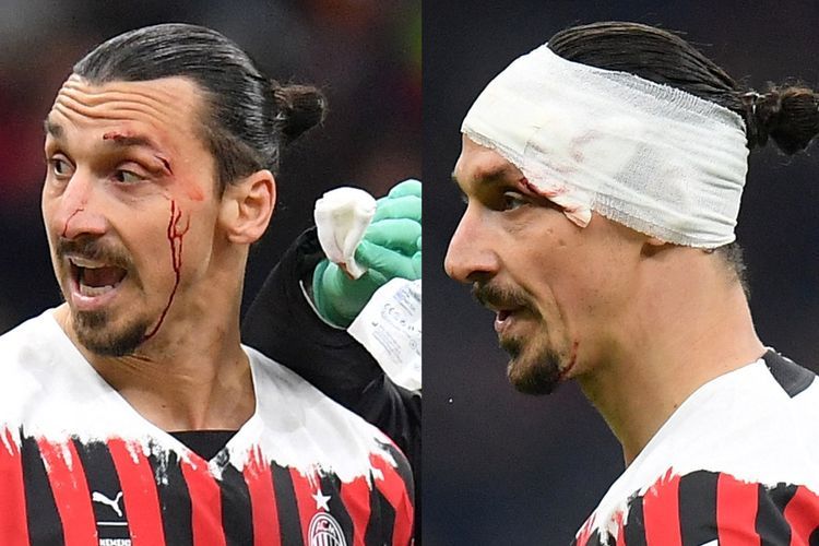 Zlatan Ibrahimovic sudah Berdarah-darah, AC Milan hanya Mampu Imbangi Bologna