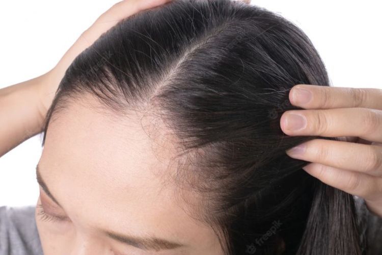 Rambut Sering Rontok Bisa Bikin Cepat Botak, Benarkah?