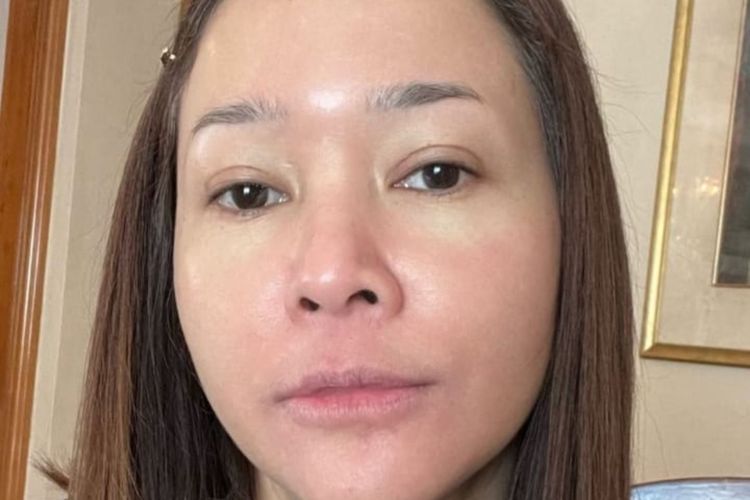 Maia Estianty Pamer Wajah Kemerahan Akibat Penyakit Rosacea, Tetap Cantik Tanpa Makeup