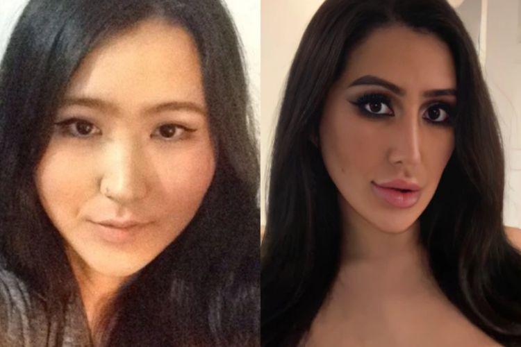 Terobsesi Kim Kardashian, Guru di Korsel Habiskan Rp900 Juta untuk Operasi Plastik