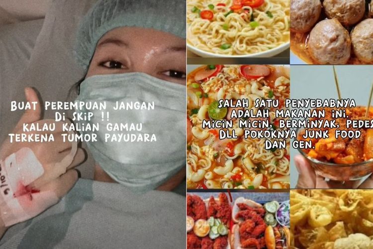 Wanita Ini Kena Tumor Payudara Akibat Keseringan Makan Junk Food dan Makanan Pedas