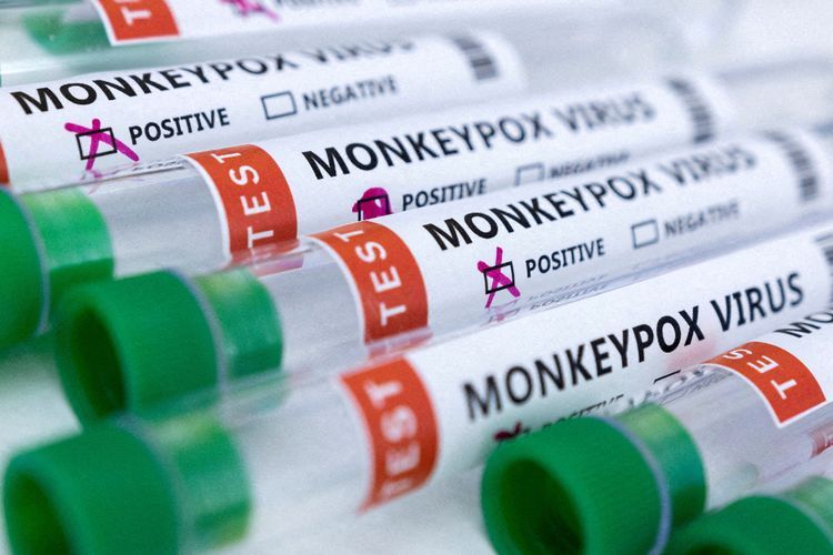 Kemenkes Ukraina Mengonfirmasi Adanya Kasus Cacar Monyet Pertama