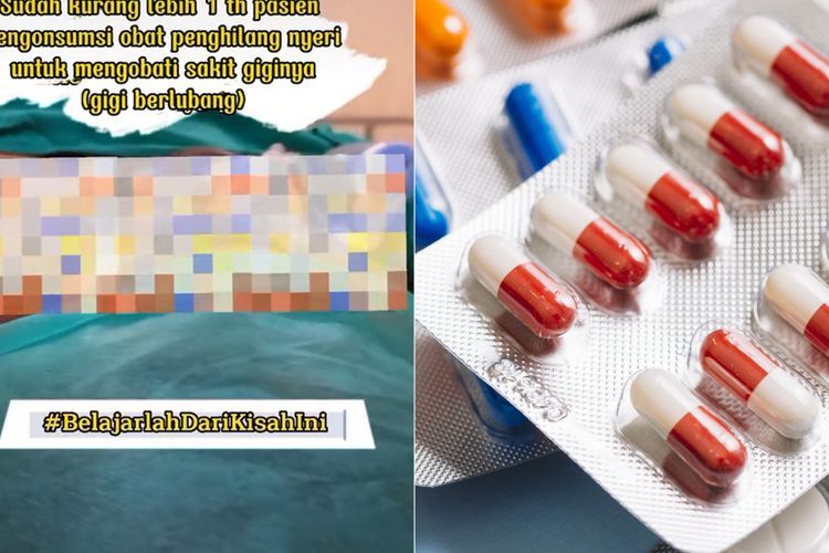 Minum Obat Pereda Nyeri untuk Mengobati Gigi Berlubang, Lambung Pria Ini Bocor