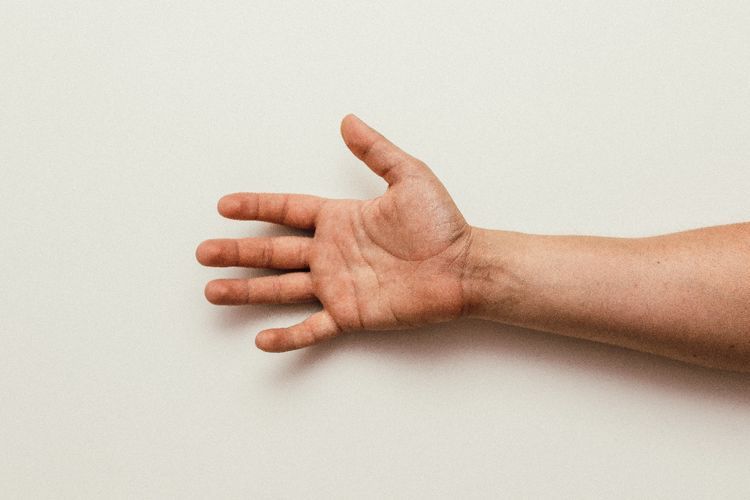 Mengenal Carpal Tunnel Syndrome yang Suka Bikin Tangan Sakit dan Kesemutan