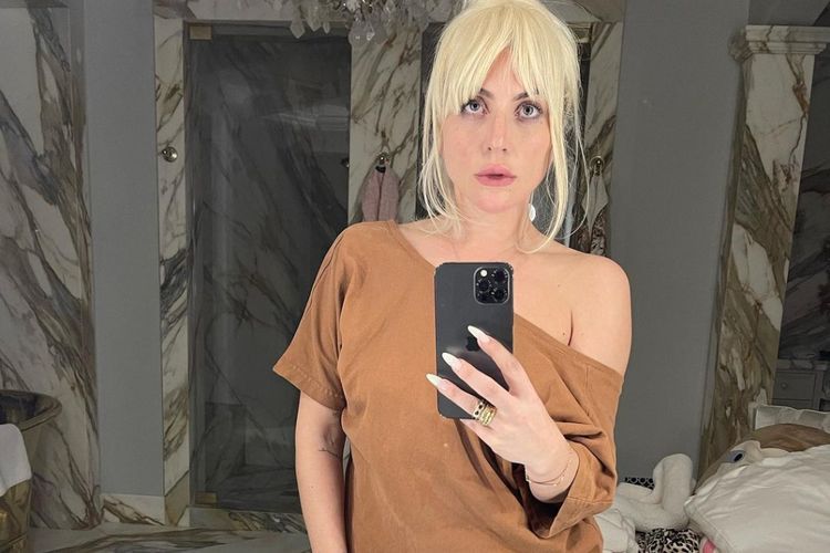 Pencuri Anjing Milik Lady Gaga Dijatuhi Hukuman 21 Tahun Penjara