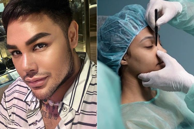 Ivan Gunawan Operasi Hidung Jadi Mancung, Kenali Efek Sampingnya sampai Bikin Mati Rasa