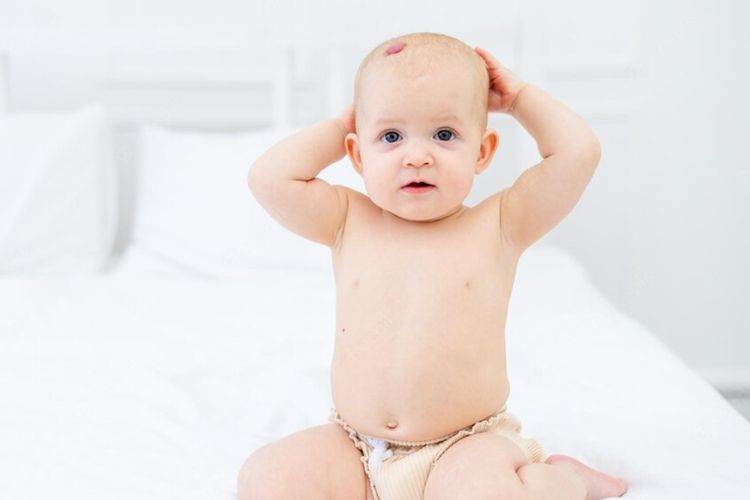 Mengenal Apa Itu Hemangioma, Benjolan Merah yang Tumbuh di Kulit Bayi