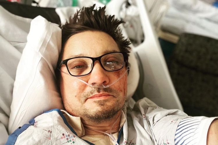 Sempat Kritis, Jeremy Renner Alami 30 Tulang Patah Akibat Kecelakaan Bajak Salju