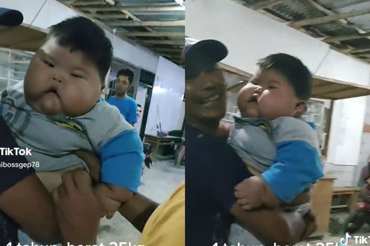 Viral Balita 1 Tahun Punya Berat Badan 25 Kg, Dokter Jelaskan Bahaya Obesitas pada Anak