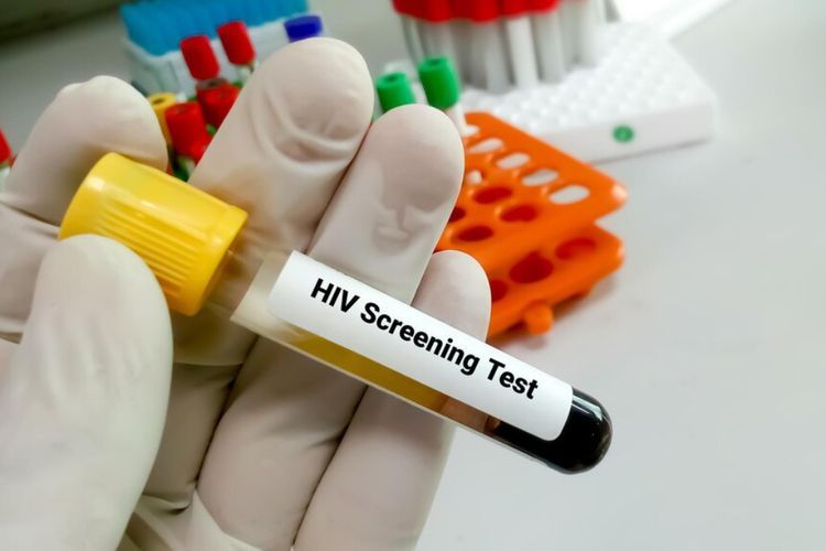 Pria 53 Tahun Asal Jerman Sembuh dari HIV Setelah Menjalani Transplantasi Sel Punca
