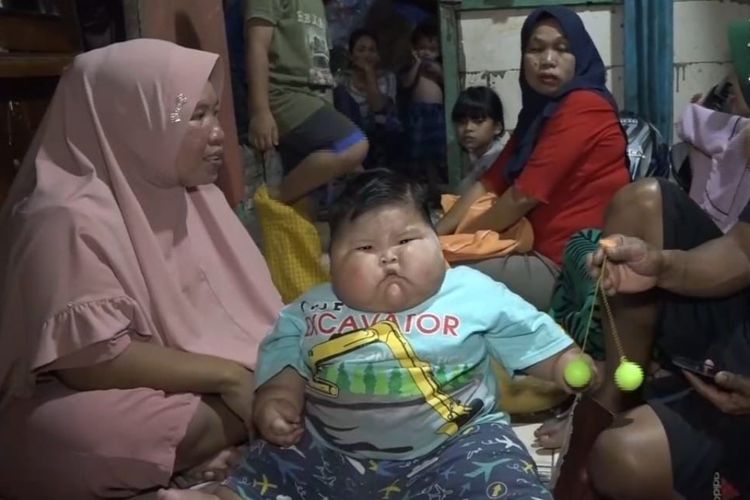 Bayi Obesitas di Bekasi Dirujuk ke Rumah Sakit untuk Penanganan Medis