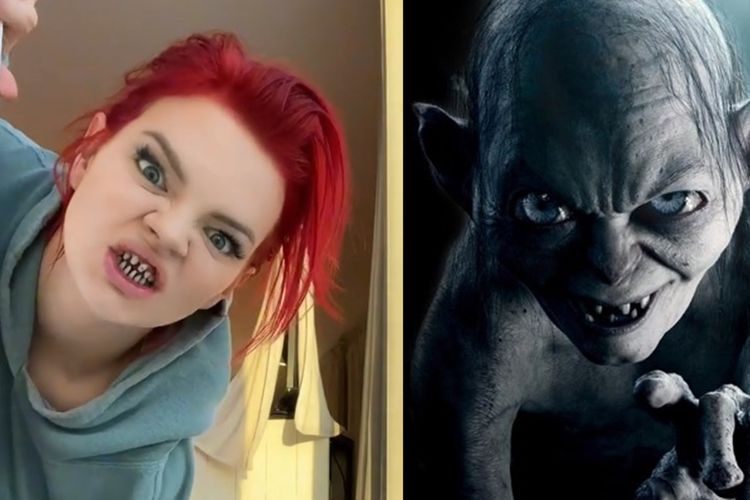 Lagi Perawatan Gigi, Model OnlyFans Ini Diejek Netizen Mirip Gollum di Lord of the Rings