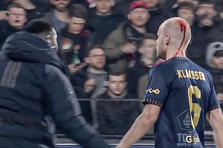 Kepala Pemain Ajax Bocor Kena Timpuk Penonton, Laga Dihentikan Sampai Setengah Jam