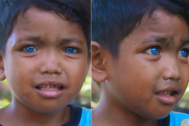 Selain Evi, Bocah Laki-laki di Sulawesi Ini Juga Bermata Biru Bak Bule Eropa