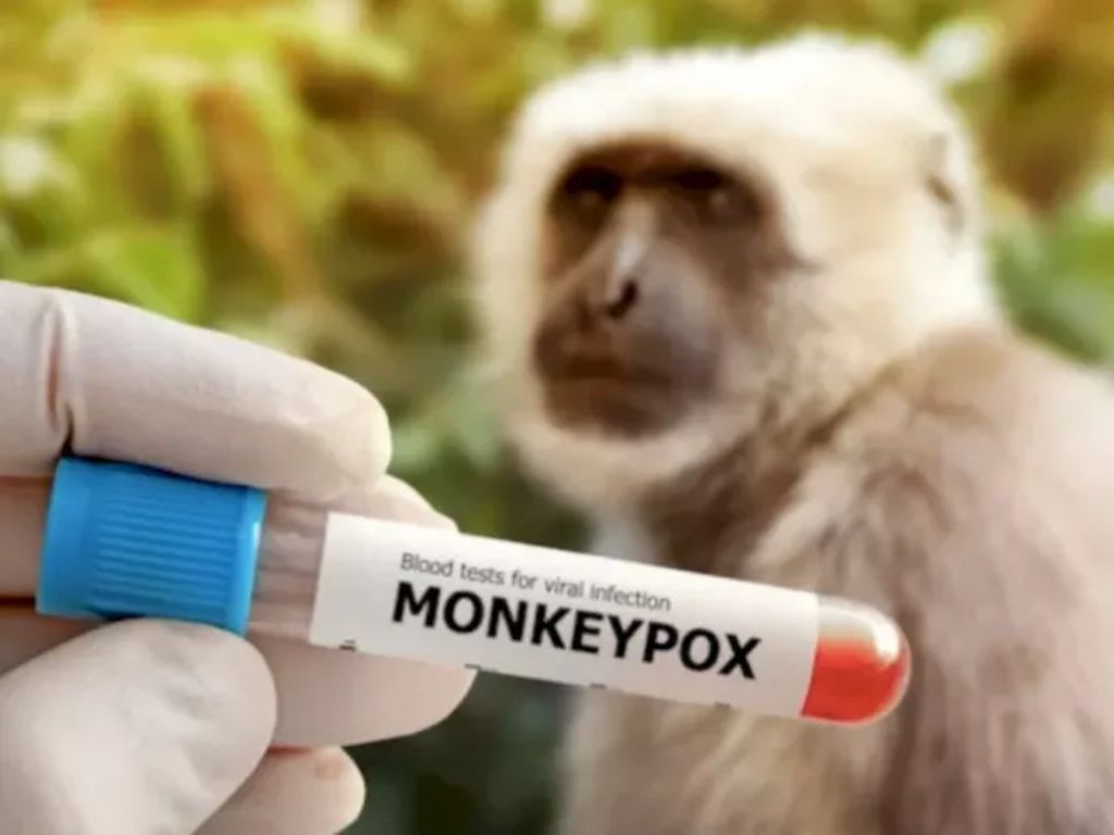 Kelompok Paling Rentan Terkena Wabah Cacar Monyet Mpox, Anak-anak atau Lansia?