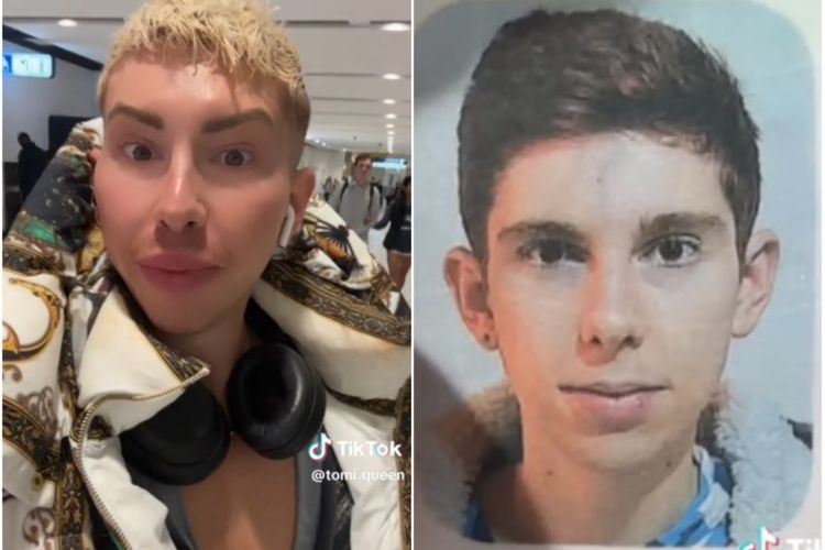 Keseringan Oplas, Drag Queen Asal Australia Ini Hampir Gak Bisa Masuk Pesawat