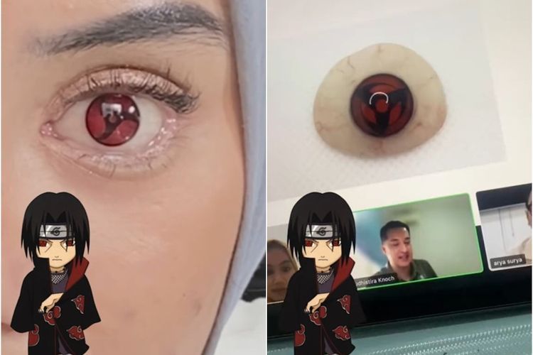 Wibu Sejati! Wanita Ini Ganti Mata Jadi Model Sharingan seperti di Naruto