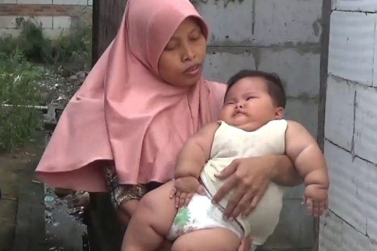 Viral Bayi 7 Bulan di Bekasi Berbobot 15 Kg, Minum 5 Botol Susu hingga Alami Sesak Nafas