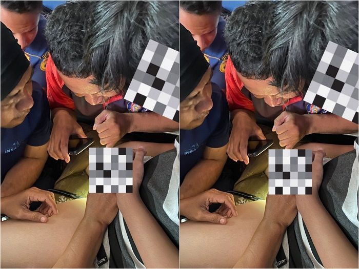 Bikin Ngilu! Kelamin ABG 15 Tahun Terjepit Resleting, Damkar Sampai Turun Tangan