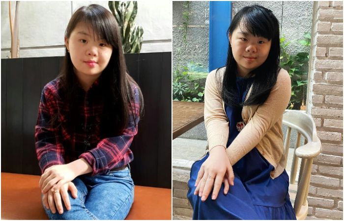 Kisah Haru Charlene Gak Malu Terlahir Down Syndrome, Pesan Buat Orangtua Punya ABK Bikin Nyesek